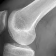 radiographie