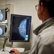 mammographie de dépistage