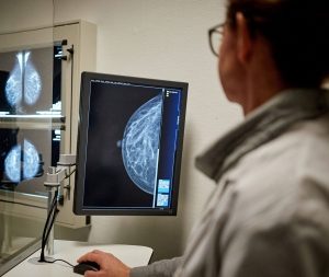 mammographie de dépistage