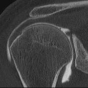 arthroscanner