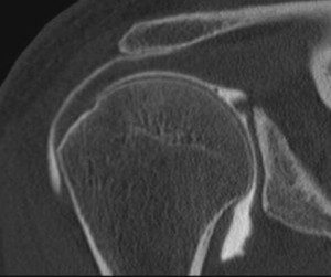 arthroscanner